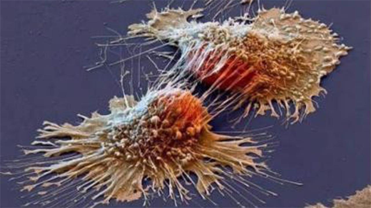 自体NK细胞免疫治疗对亚健康人群生活质量的临床研究(图1)
