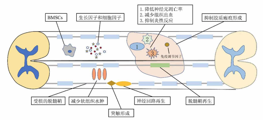 盘(pán)点(diǎn)近(jìn)2年(nián)干细(xì)胞(bāo)治(zhì)疗(liáo)脊(jí)髓(suǐ)损(sǔn)伤(shāng)临(lín)床(chuáng)进(jìn)展(zhǎn)：我(wǒ)国(guó)启(qǐ)动(dòng)临(lín)床(chuáng)招(zhāo)募(mù)，多(duō)名患(huàn)者(zhě)得(de)到(dào)改(gǎi)善(shàn)(图(tú)9)